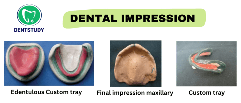 Dental Impression for Viva Preparation